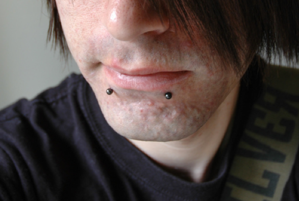 Snakebite Lip Face Piercing Liverpool